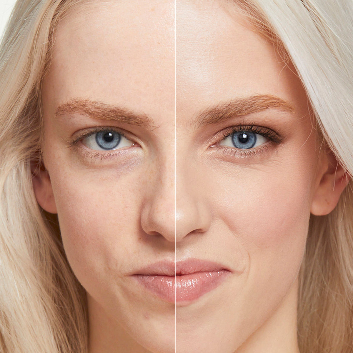 a side by side before and after of a model showing how effectively the products in Fold Out Face cover blemishes, add natural-looking color and create a smooth, beautiful skin tone